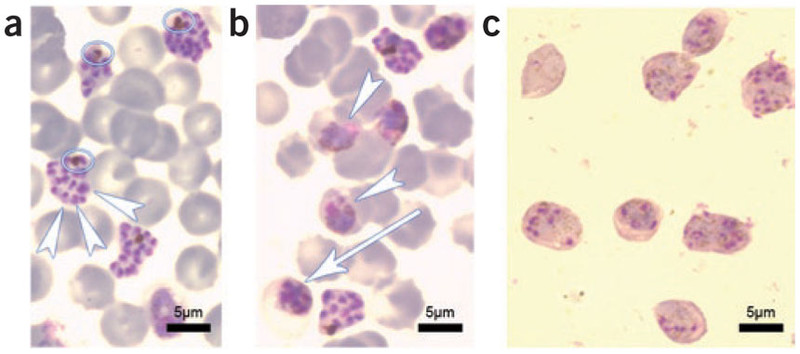 plasmodium berghei2 (egér, patkány)