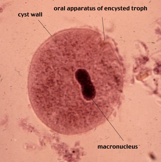 balantidium coli2